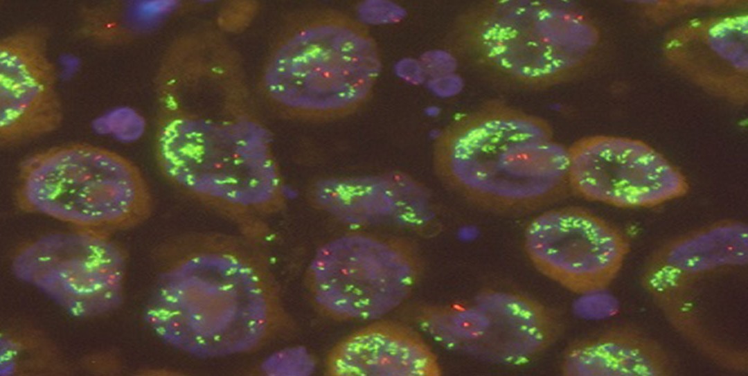 MET – ein vielversprechendes Target