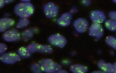 MET Inhibition jetzt auch in der Erstlinie möglich